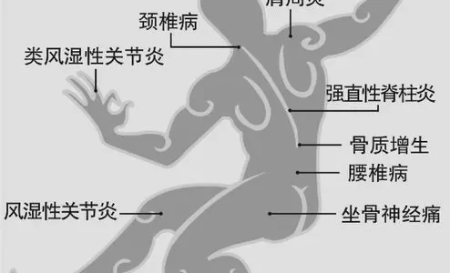 这款藏药居然能治好痛风！真的有这样的神奇